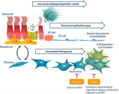 Challenges for Clinical Drug Development in Pulmonary Fibrosis